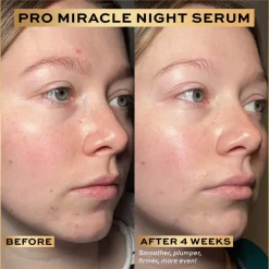 Revolution Beauty Revolution Pro Miracle Night Rescue Serum Advanced Complex 30ml^ Peptides|Ceramides