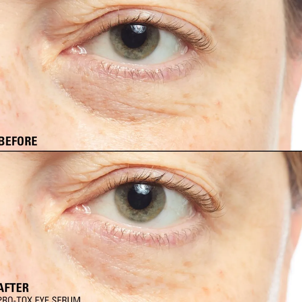 Revolution Beauty Revolution Pro Miracle Pro-Tox Instant Fix Eye Firm^ Dark Circles|Anti-Ageing