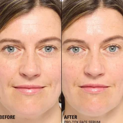 Revolution Beauty Revolution Pro Miracle Pro-Tox Fine Line Fix & Fill Serum 30ml^ Peptides|Anti-Ageing