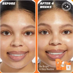 Revolution Beauty Revolution Skin Be Bright 4 Step Starter Kit Minis^ Glycolic Acid|Vitamin C