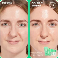 Revolution Beauty Revolution Skin Clear Canvas 5% Niacinamide & 2% Salicylic Acid Clarifying Serum 30ml^ Niacinamide|Dark Spots & Hyperpigmentation