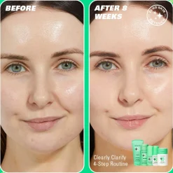Revolution Beauty Revolution Skin Clearly Clarify 4 Step Starter Kit Minis^ Salicylic Acid|Niacinamide
