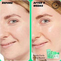 Revolution Beauty Revolution Skin Clearly Clarify 4 Step Starter Kit Minis^ Salicylic Acid|Niacinamide
